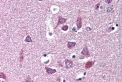 Kv1.3 Antibody, Novus Biologicals 50 &mu;g | Buy Online | Novus Biologicals | Fisher Scientific